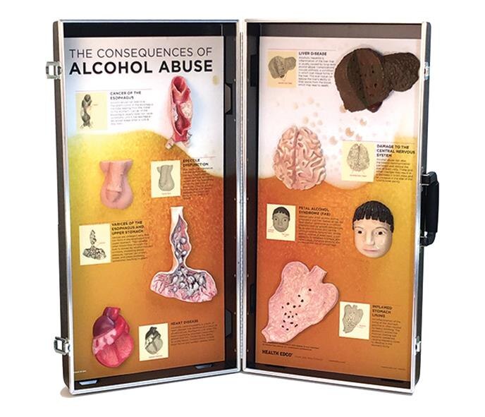 alcohol abuse health consequences display