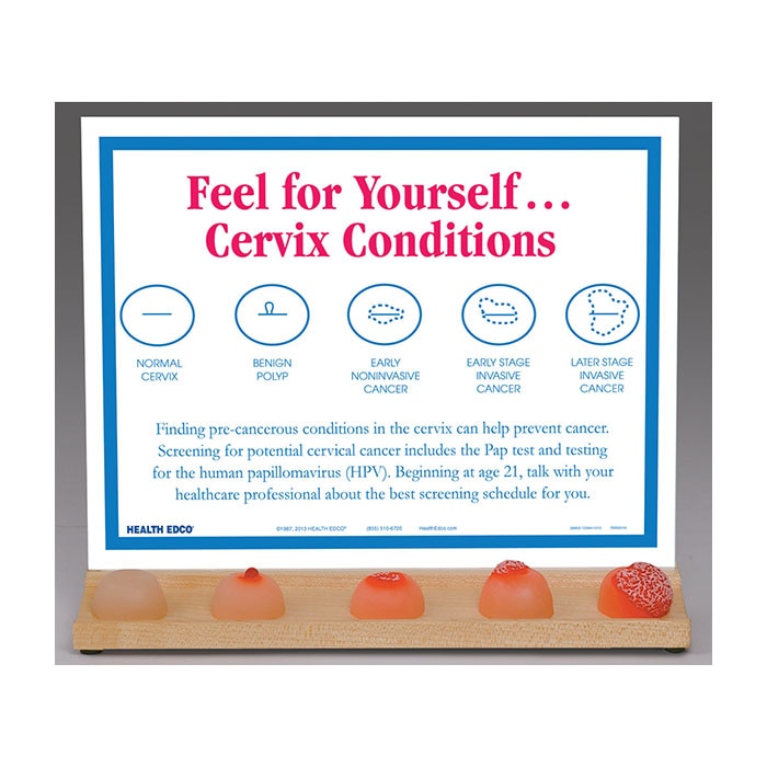 development of cervical cancer educational display