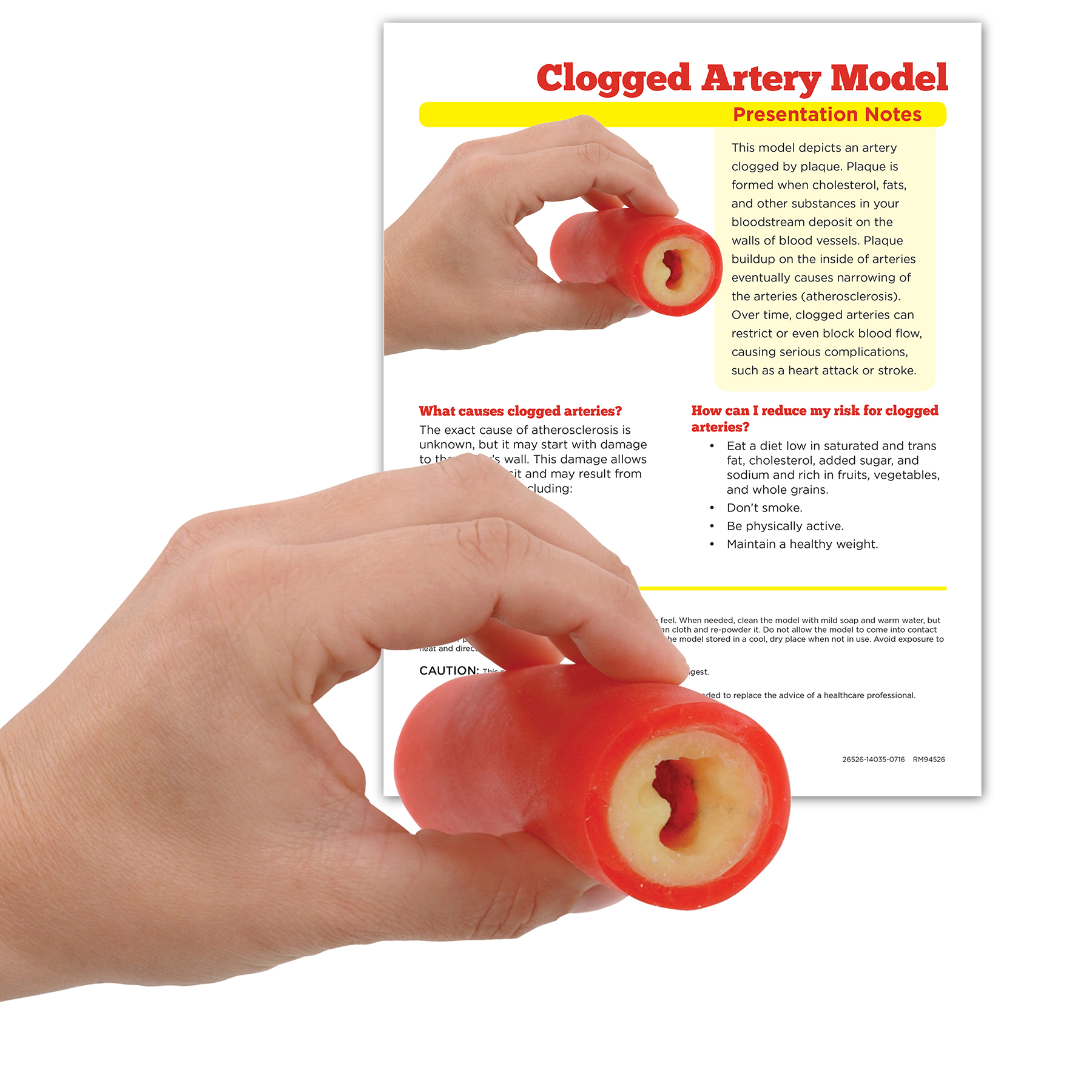Clogged Artery Model from Health Edco