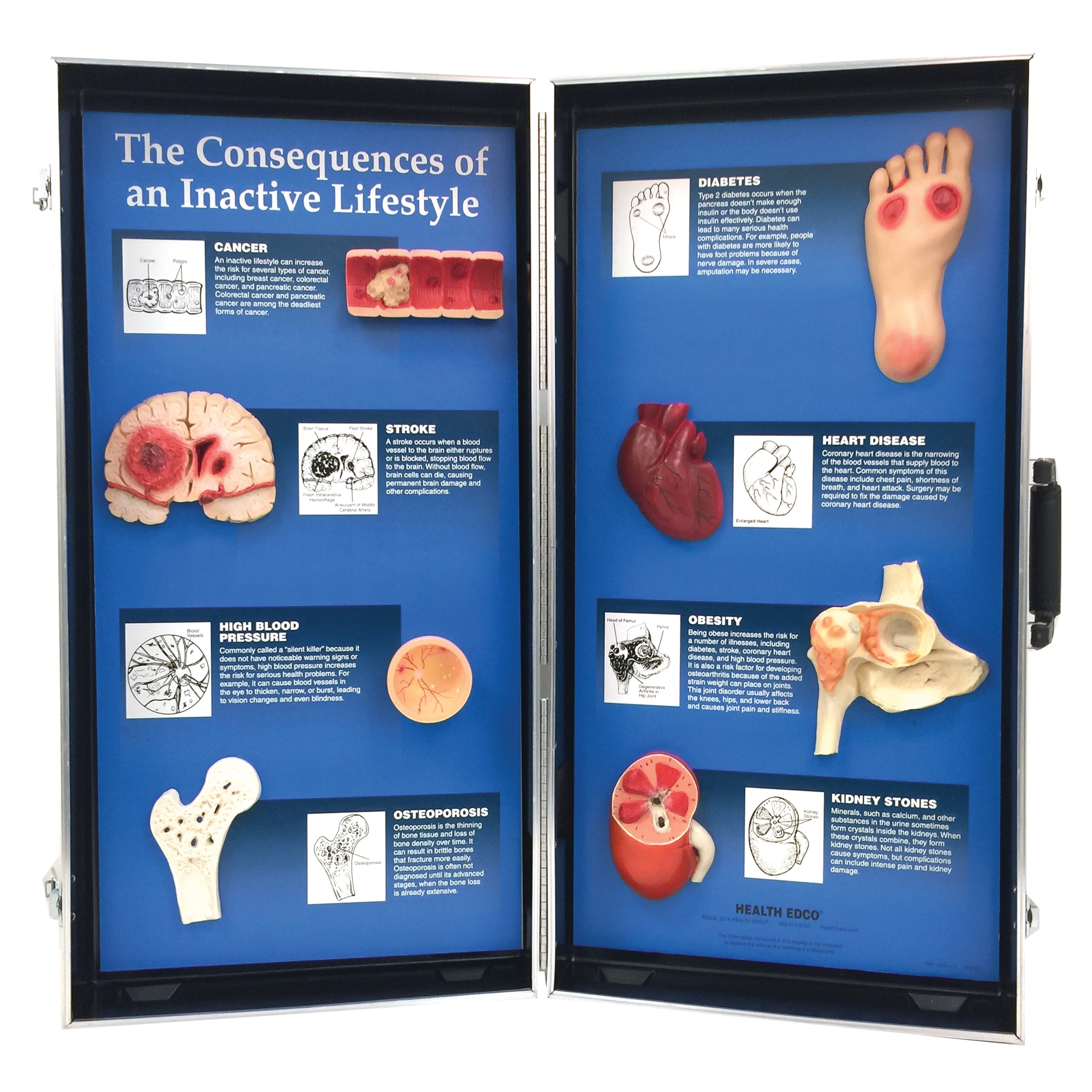 Consequences of an Inactive Lifestyle 3-D Display