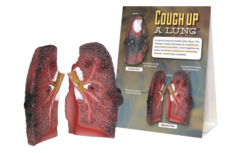 Cough Up a Lung Model for tobacco education from Health Edco