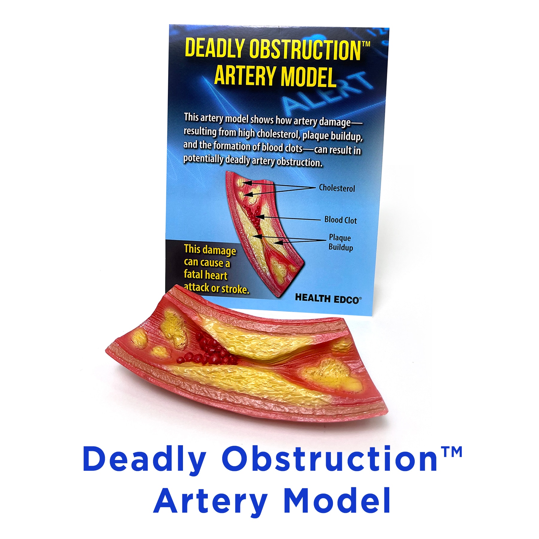 Deadly Obstruction Artery Model, heart health education model showing development of clogged arteries, Health Edco, 26989