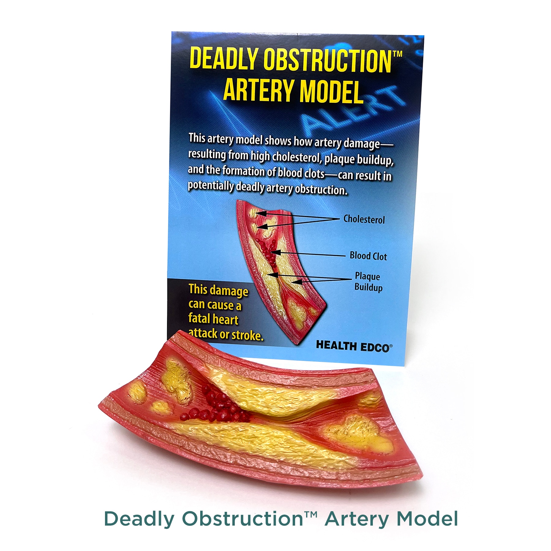 Deadly Obstruction Artery Model from Health Edco, 26989