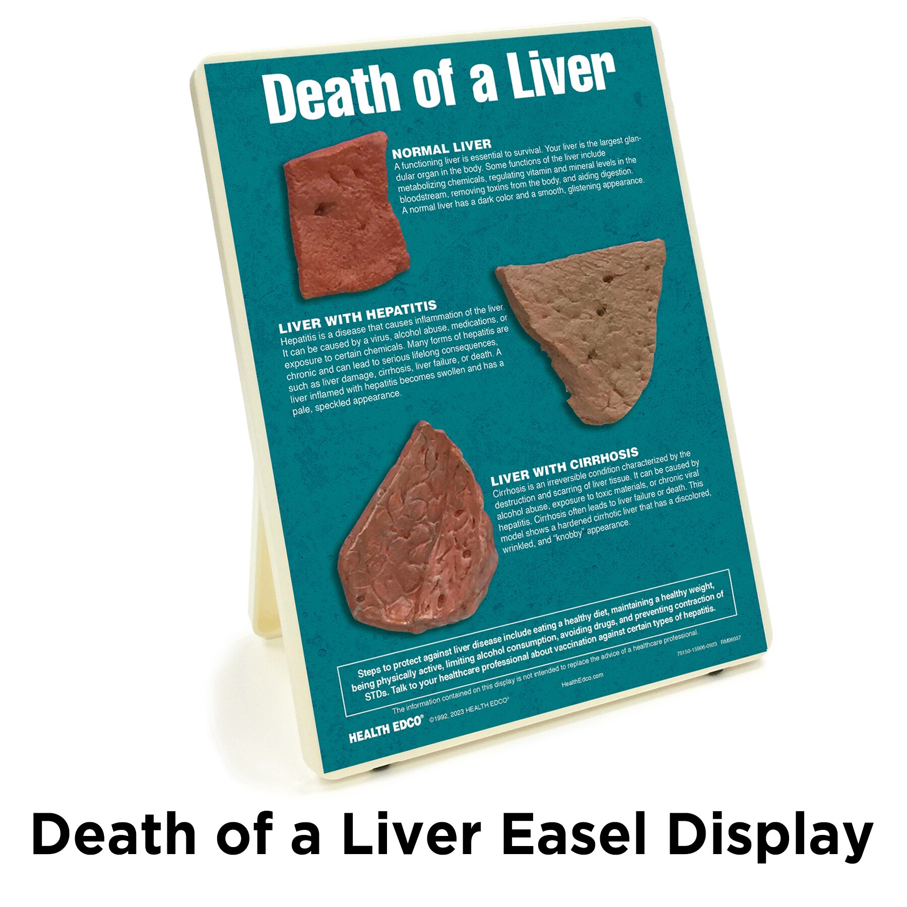 Death of a Liver Easel Display, health education display with liver models showing liver damage, Health Edco, 79150