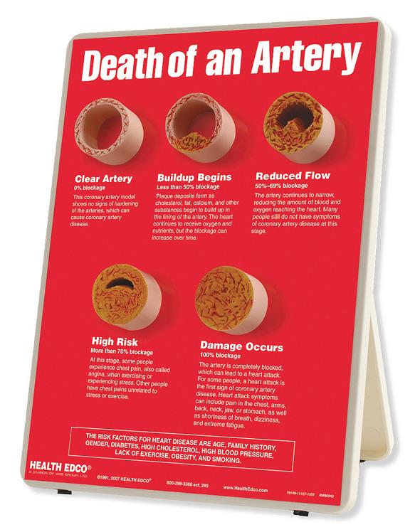 Death of an Artery Easel Display from Health Edco