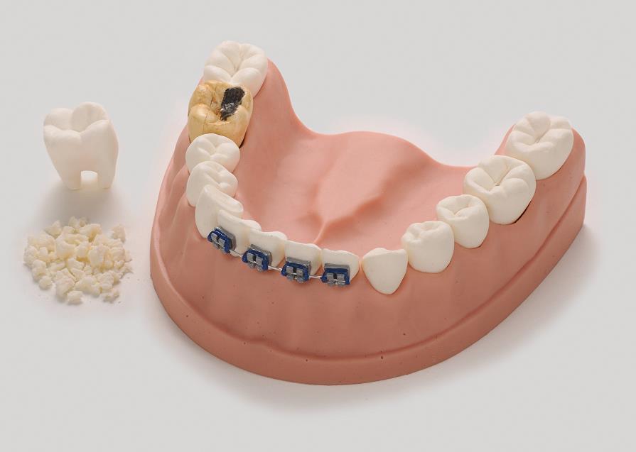 Dental Health Model from Health Edco