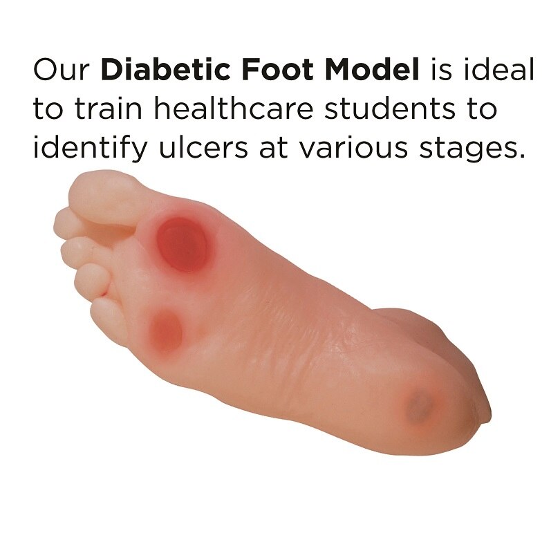 Diabetic Foot Model for health education from Health Edco, 26101