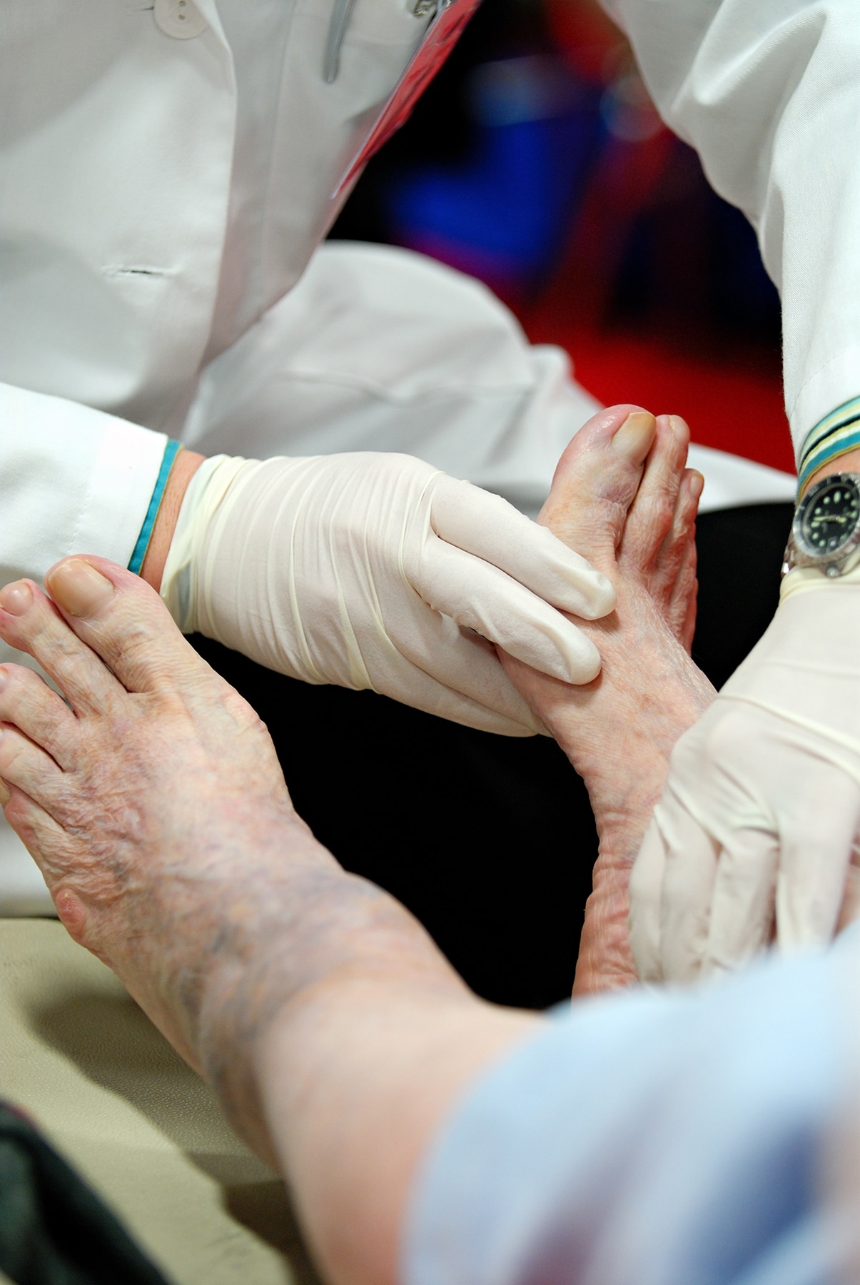 Doctor examining an elderly person’s diabetic foot