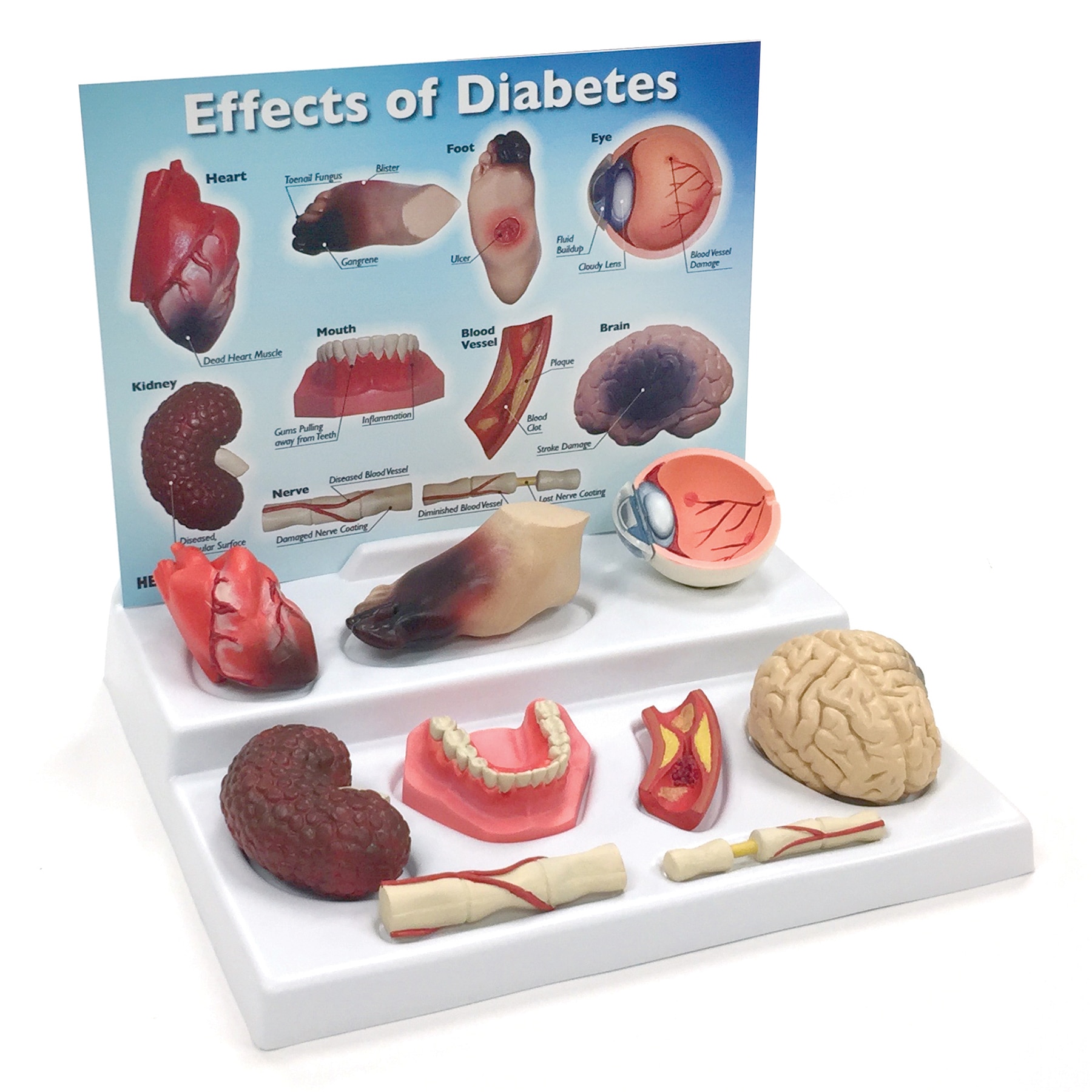 Effects of Diabetes Display