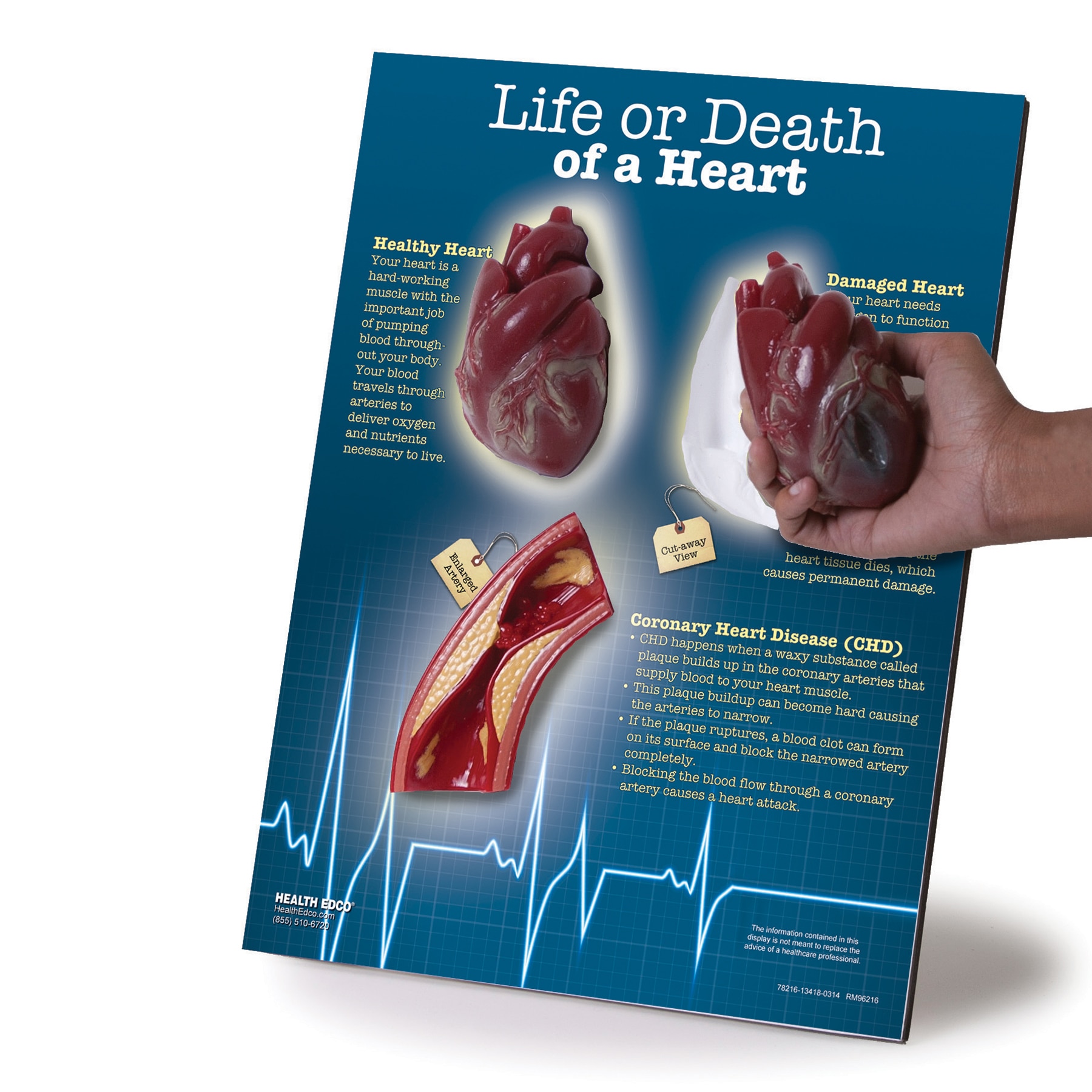 healthy heart, damaged heart, and clogged artery display