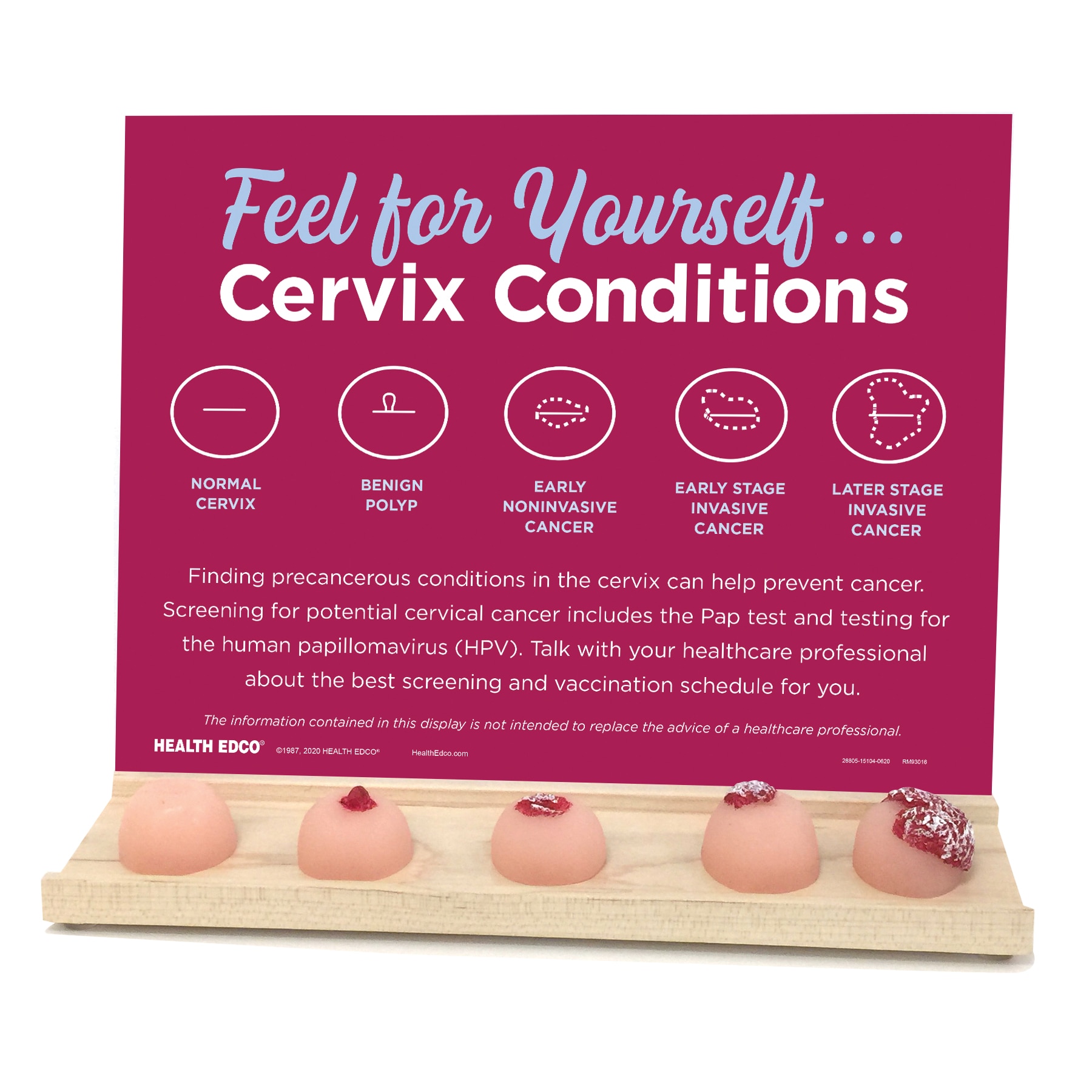 Feel for Yourself: Cervix Conditions Display from Health Edco