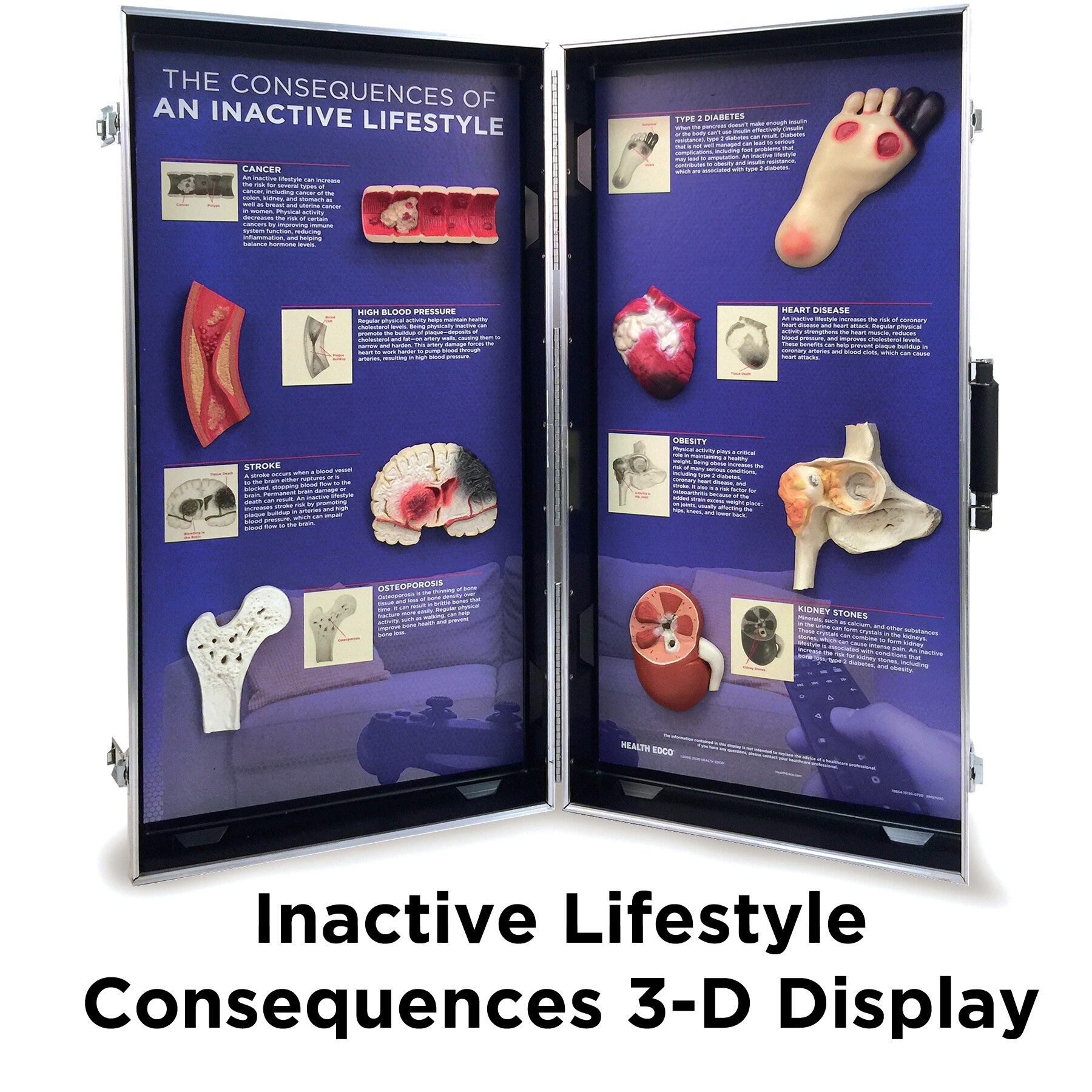Inactive Lifestyle 3-D Display, Health Edco health education display with models of sedentary lifestyle health effects, 78854