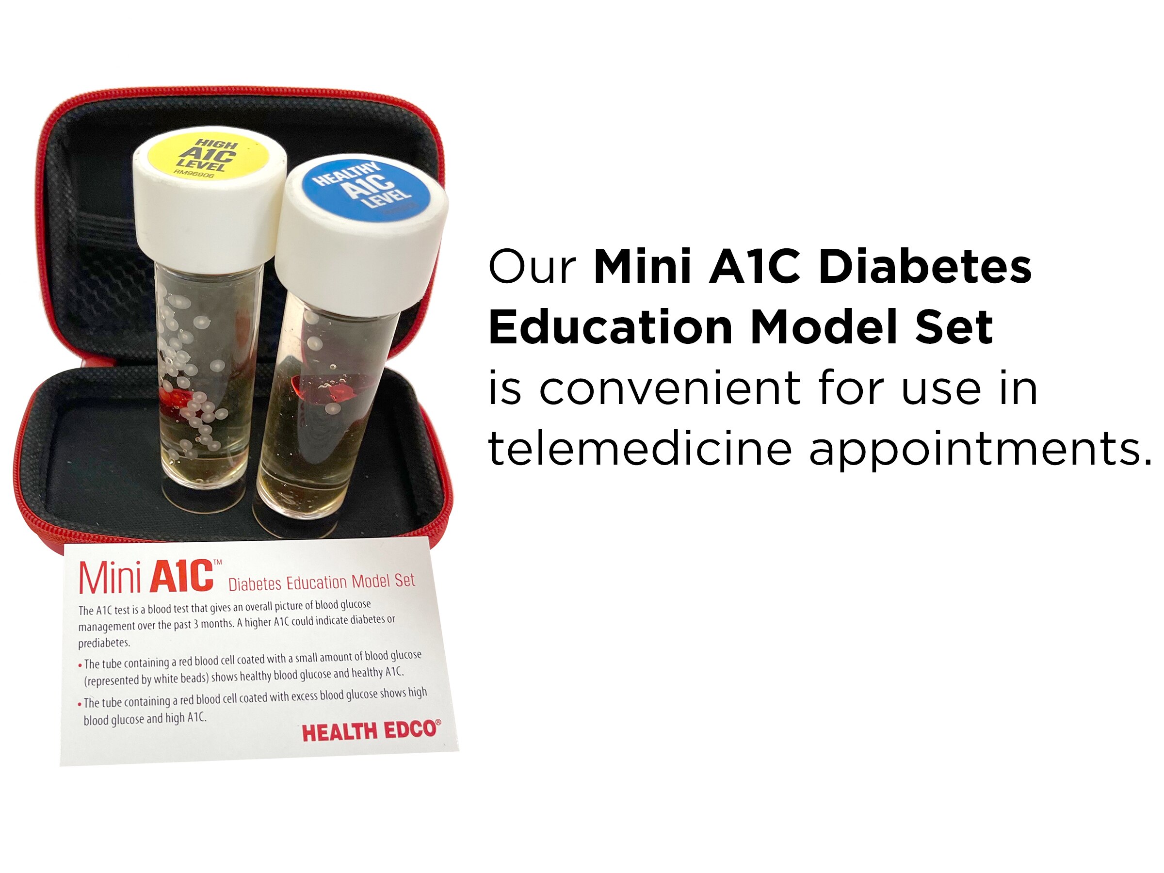 Mini A1C Diabetes Model Set for health education from Health Edco, 78920