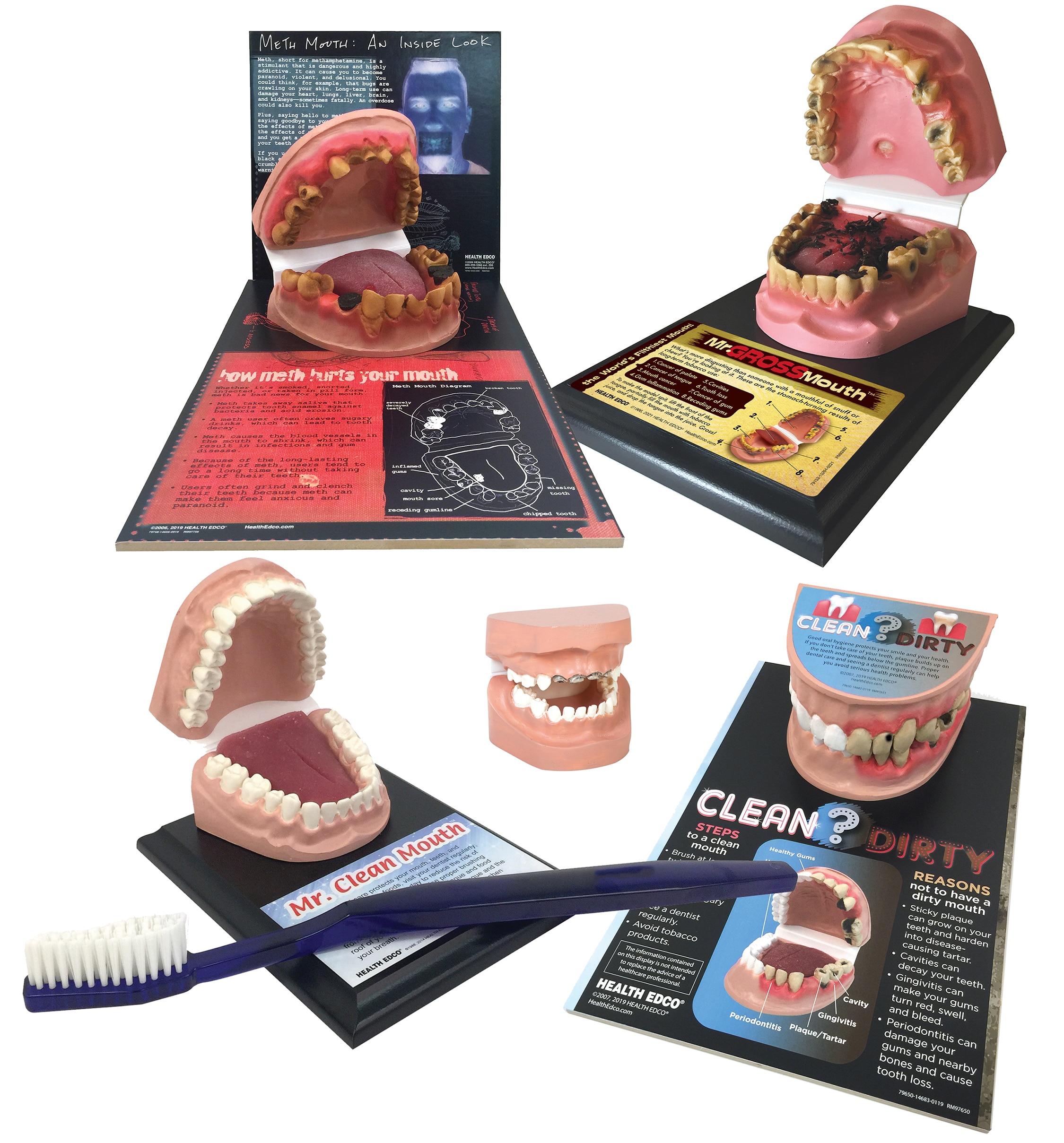 Health Edco Oral Health and Mouth Models