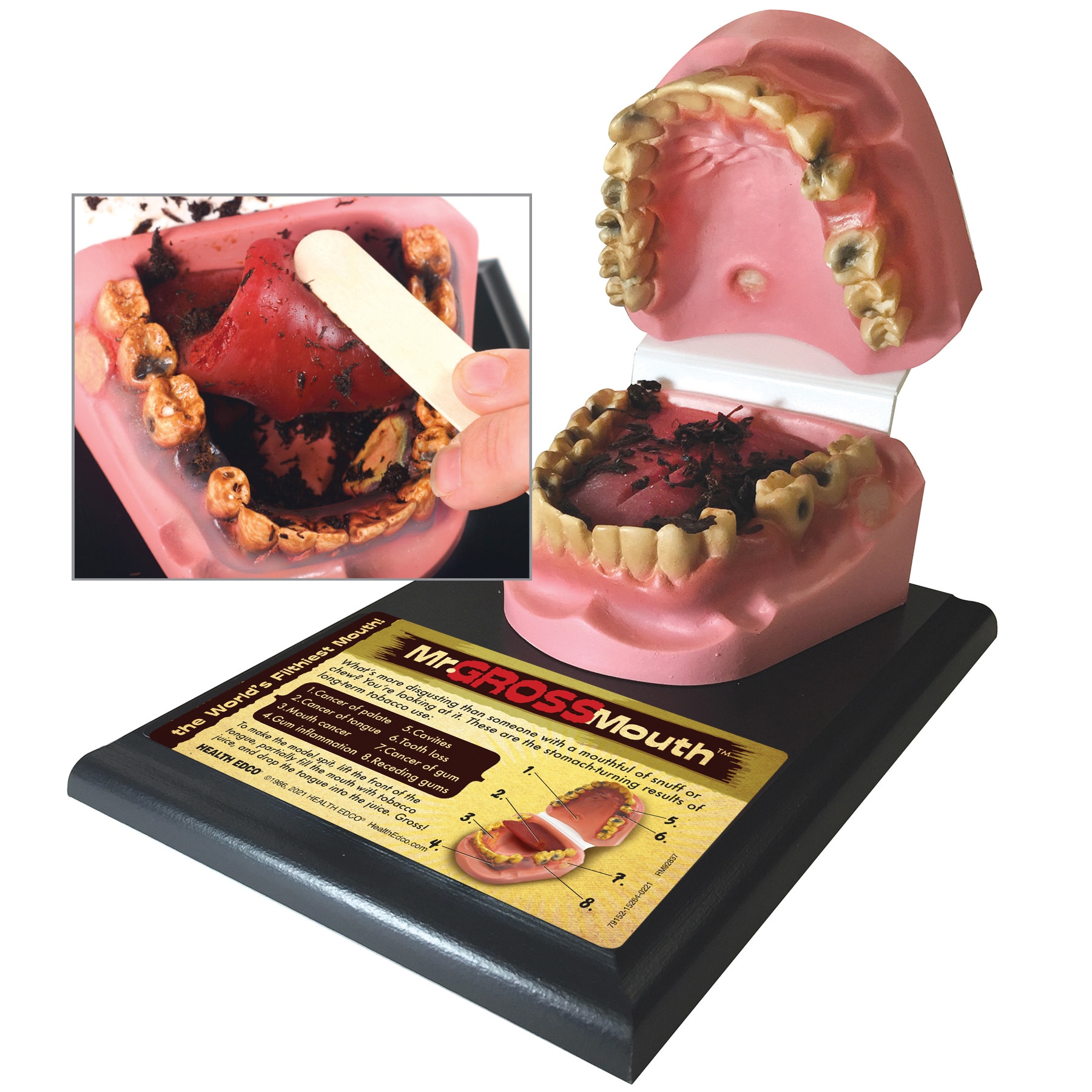 Mr. Gross Mouth Model from Health Edco