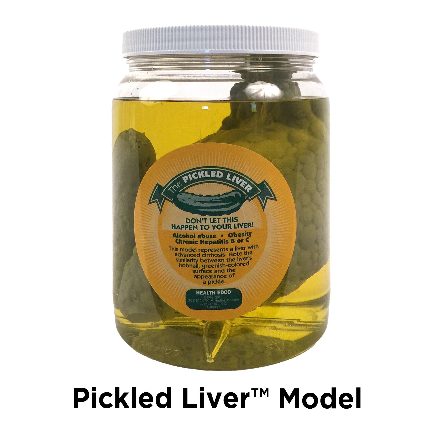Pickled Liver Model, health education display with liver model to show cirrhotic liver next to a pickle, Health Edco, 79723