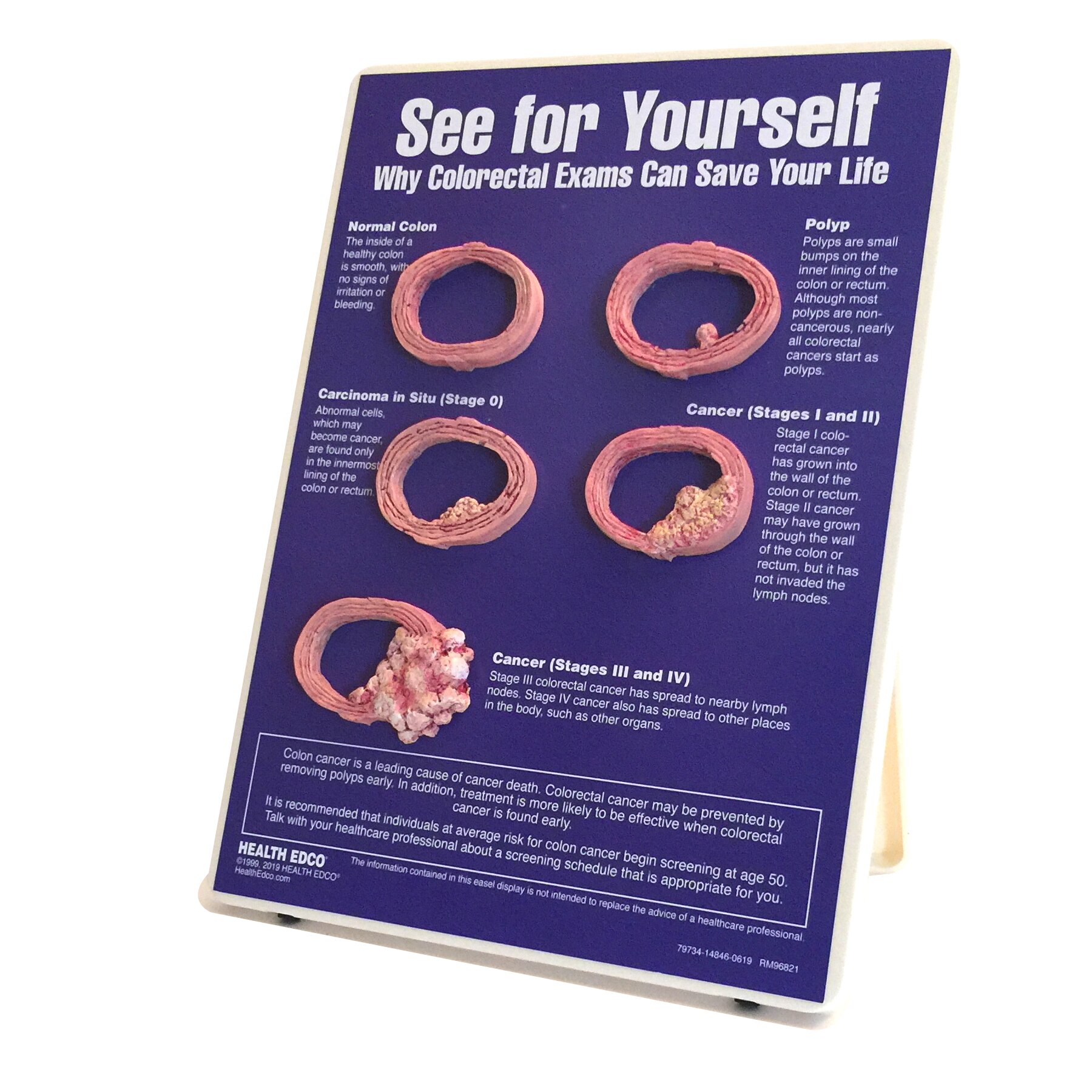 See for Yourself: Colorectal Exams Easel Display from Health Edco