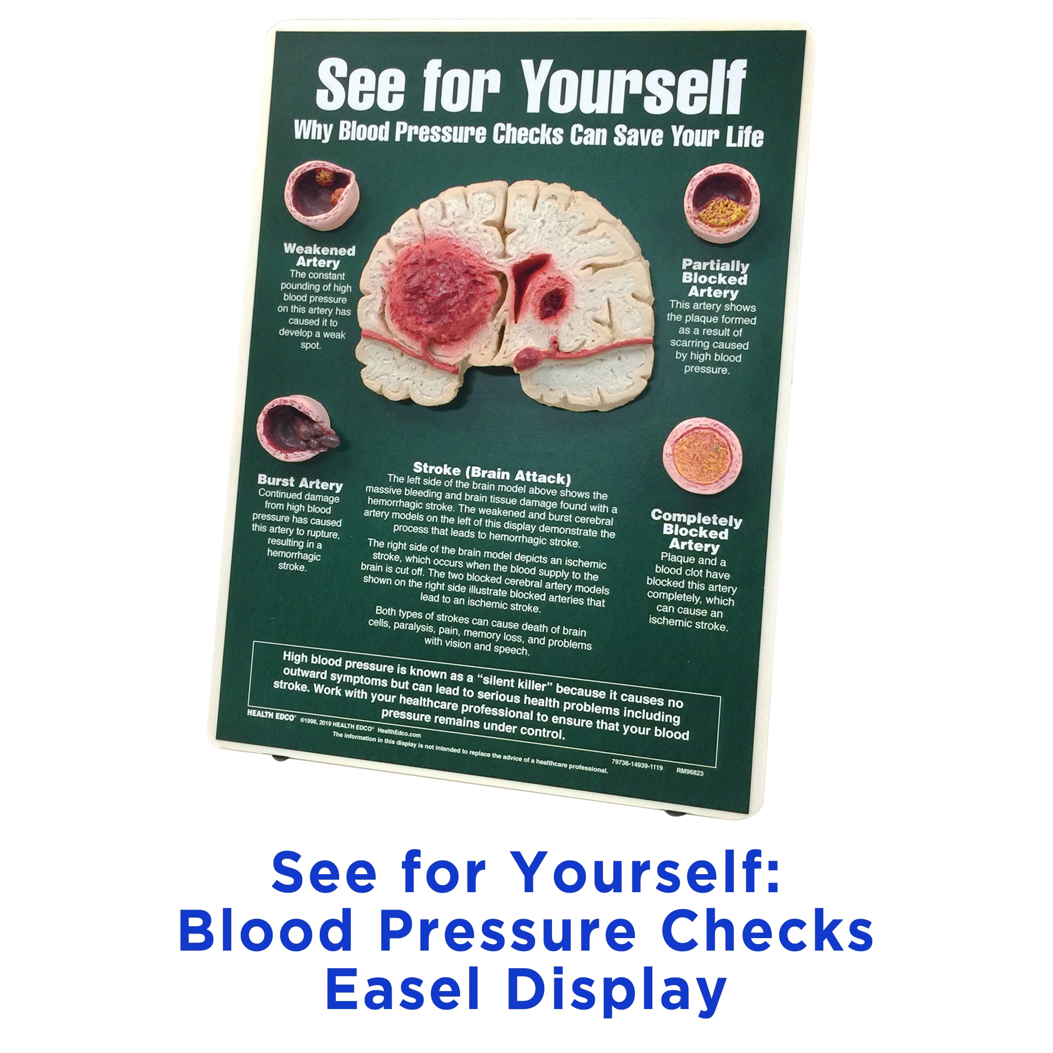  See for Yourself Blood Pressure Checks Easel Display for health education by Health Edco with brain and artery models, 79736
