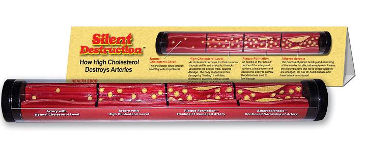 Silent Destruction: How High Cholesterol Destroys Arteries Display