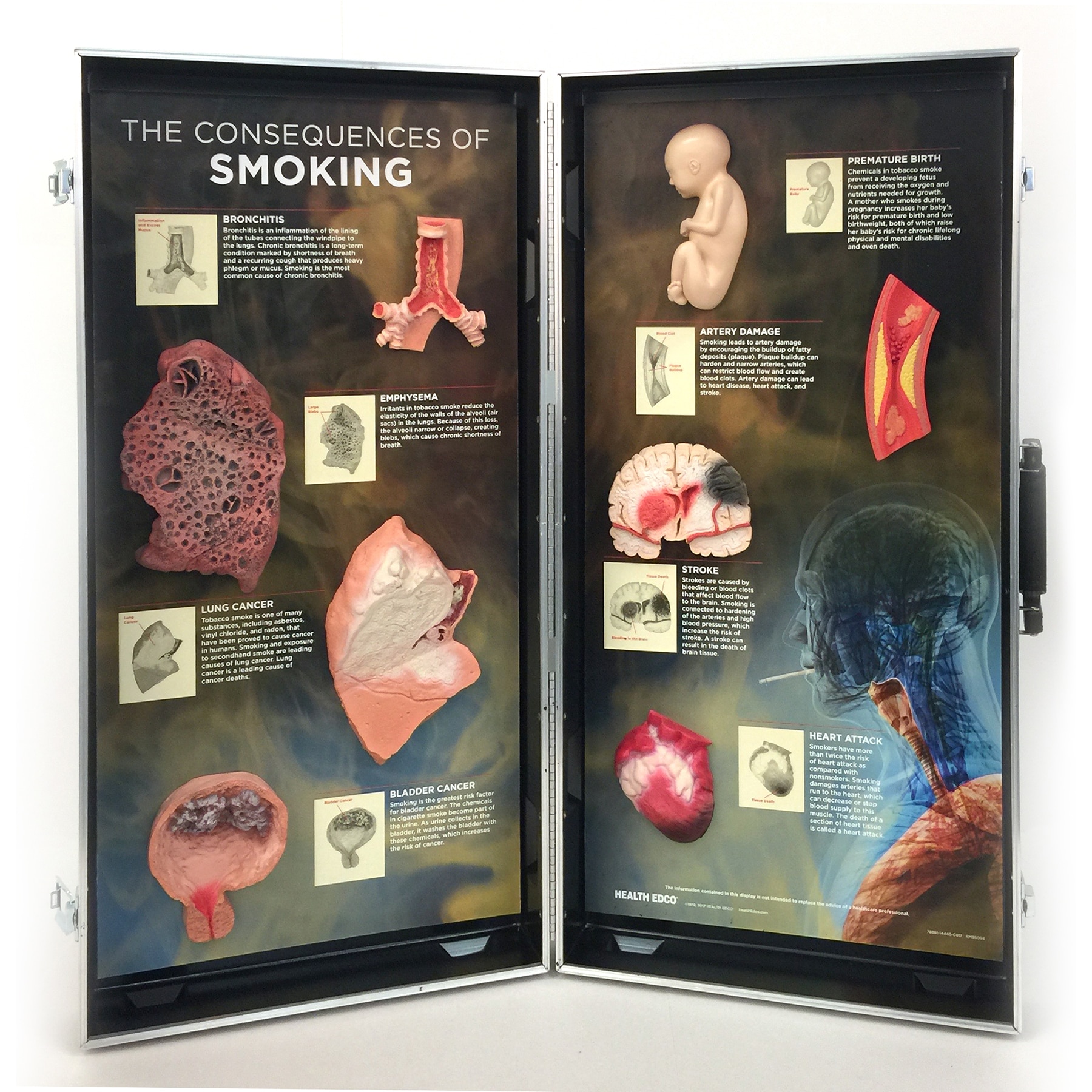 Smoking Consequences 3-D Display from Health Edco