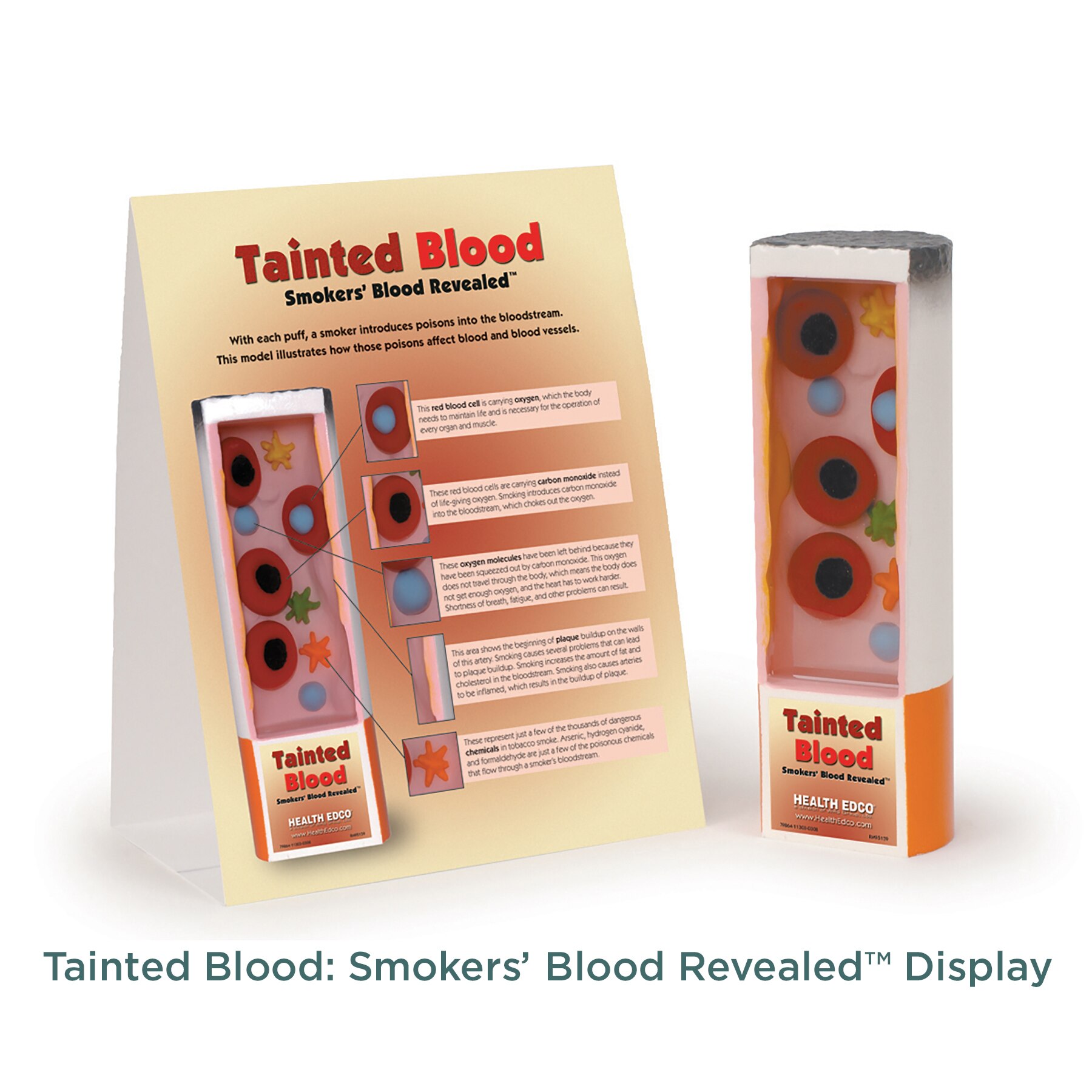 Tainted Blood: Smokers’ Blood Revealed Display from Health Edco, 79864