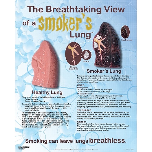 The Breathtaking View of a Smoker’s Lung 3-D Chart from Health Edco