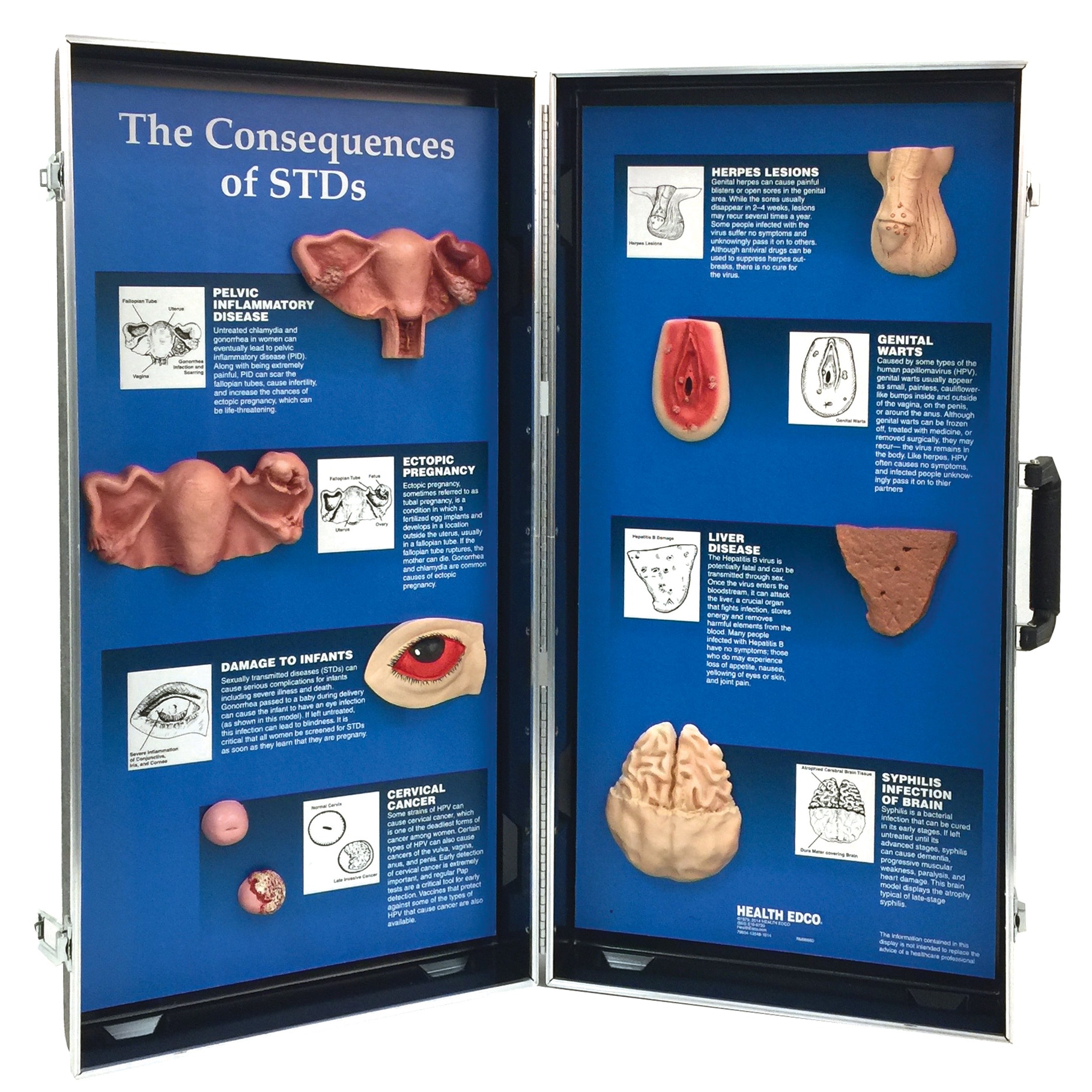 The Consequences of STDs for sex and relationships education from Health Edco