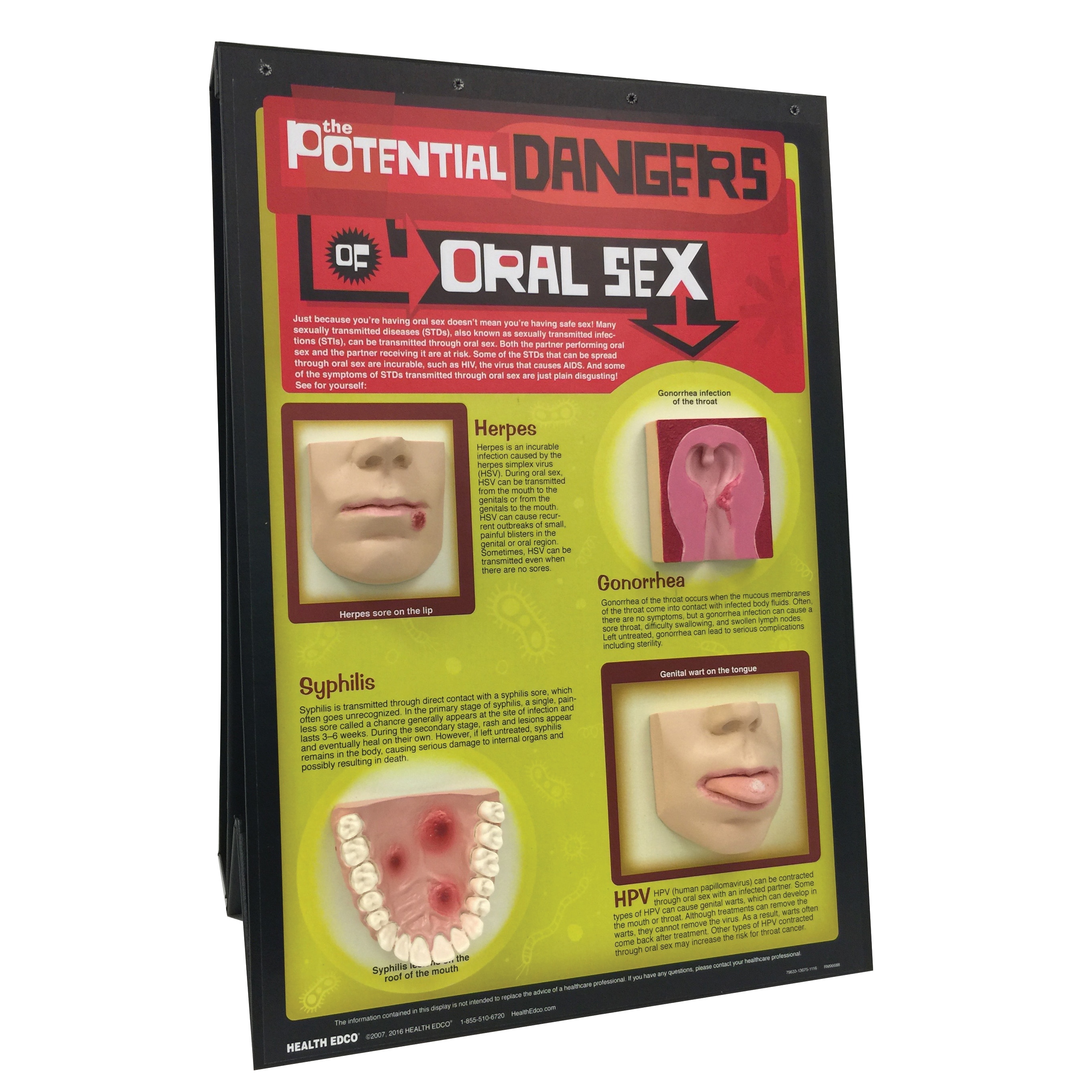 The Potential Dangers of Oral Sex 3-D Display for sex and relationships education from Health Edco