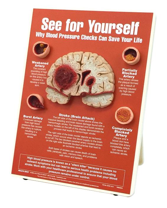 See for Yourself: Blood Pressure Checks Educational 3-D Display from Health Edco