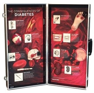 diabetic health consequences 3-D display