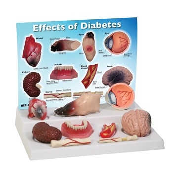 diabetic organ damage models